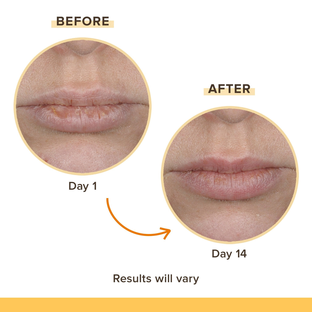 Burt's Bees Rescue Balm Lip Balm Pack, 4-Pack, 0.15 oz.