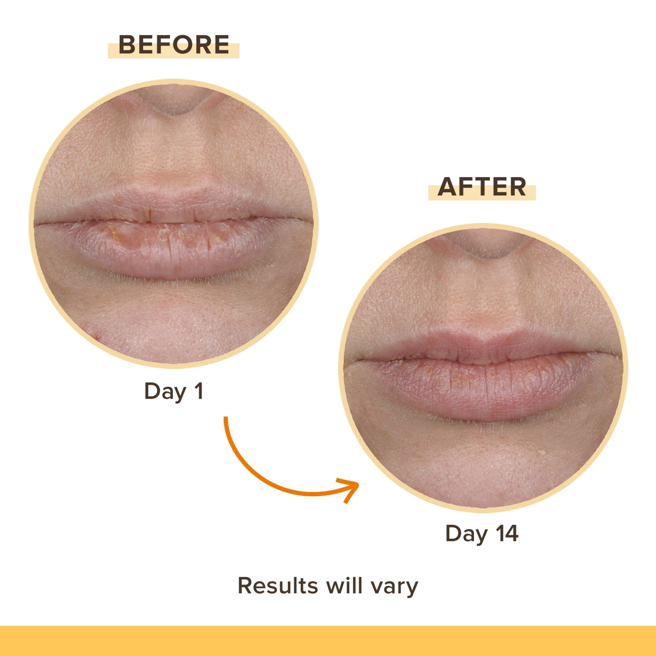 Burt's Bees Rescue Balm Lip Balm Pack, 4-Pack, 0.15 oz.